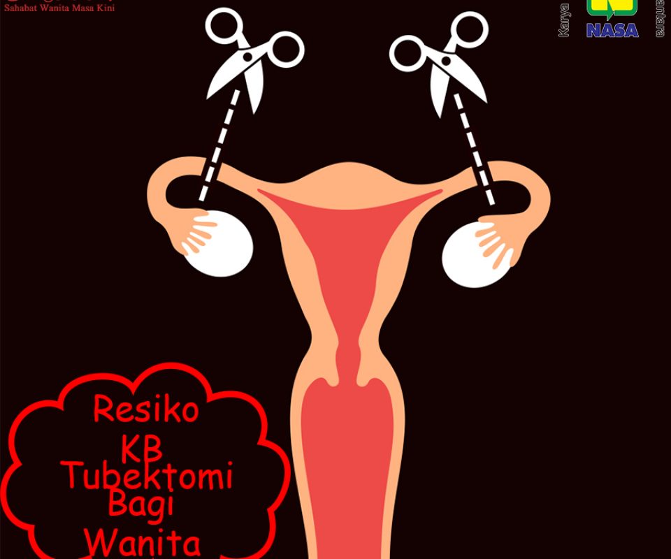 Resiko Penggunaan KB Tubektomi Bagi Wanita